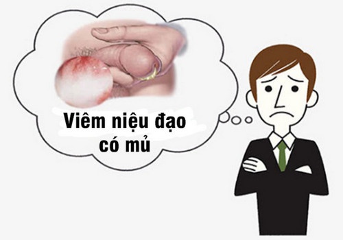 Nguyên nhân gây ra viêm niệu đạo nam và cách phòng tránh an toàn | Phòng Khám Đa Khoa An Giang