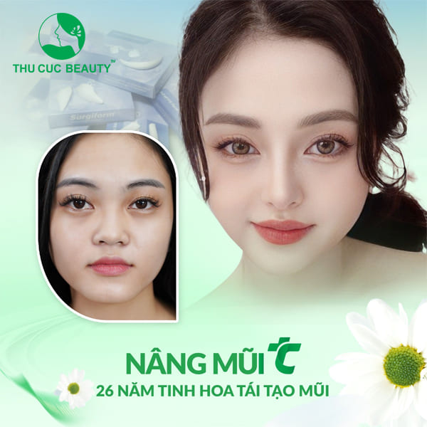 Nâng mũi sụn tự thân - Thu Cúc Sài Gòn