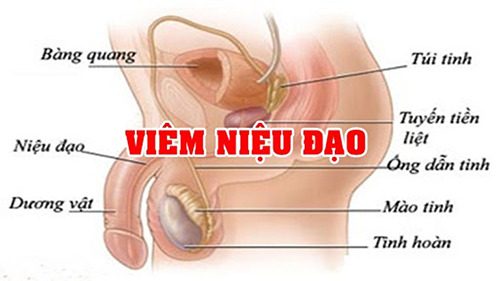 #Địa chỉ chữa viêm niệu đạo uy tín tại Tiền Giang - Phòng Khám Nam Khoa An Giang