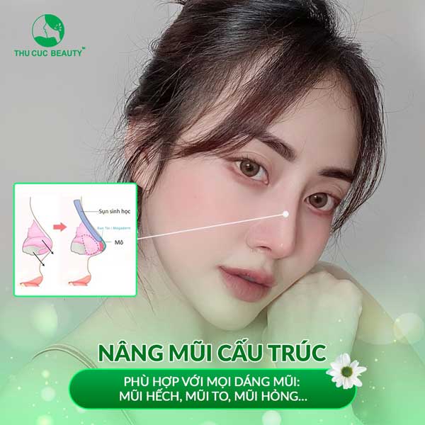 Nâng mũi cấu trúc L Line - Thu Cúc Sài Gòn