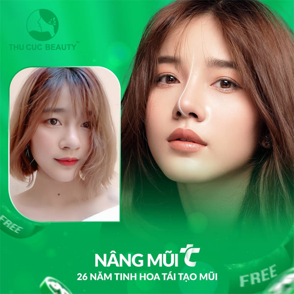 Nâng mũi có hại về sau không? - Thu Cúc Sài Gòn