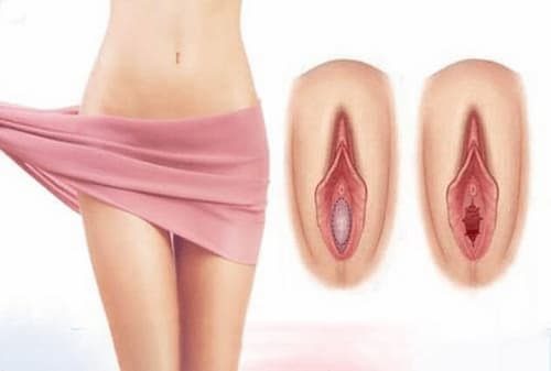 ✲Địa chỉ vá màng trinh uy tín tin cậy tại Bạc Liêu