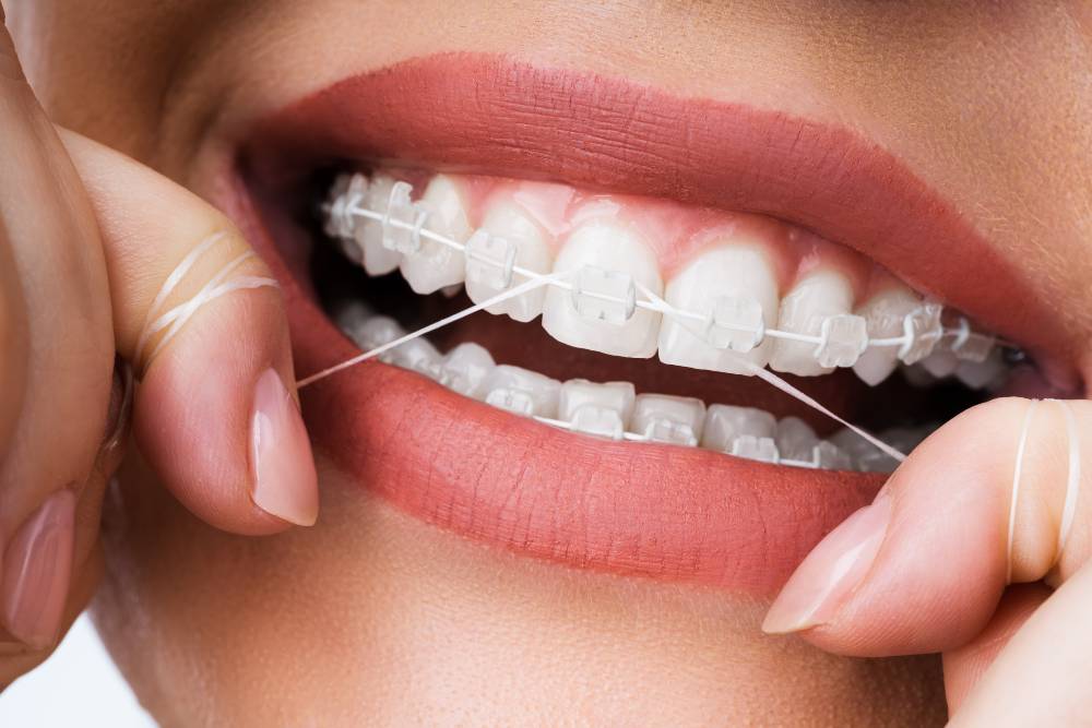 Understanding the Process of Orthodontics Crawfordville FL
