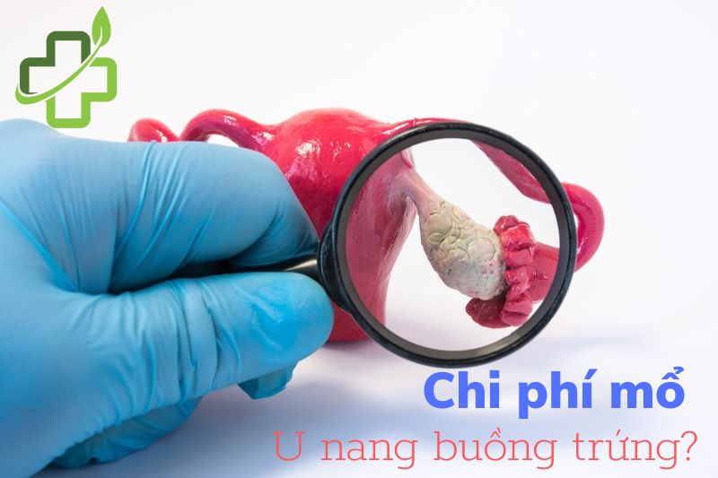 Chi phí mổ u nang buồng trứng năm 2022 là bao nhiêu?