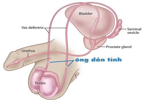Viêm ống dẫn tinh uống thuốc gì? Chia sẻ từ chuyên gia - Phòng Khám Đa Khoa An Giang