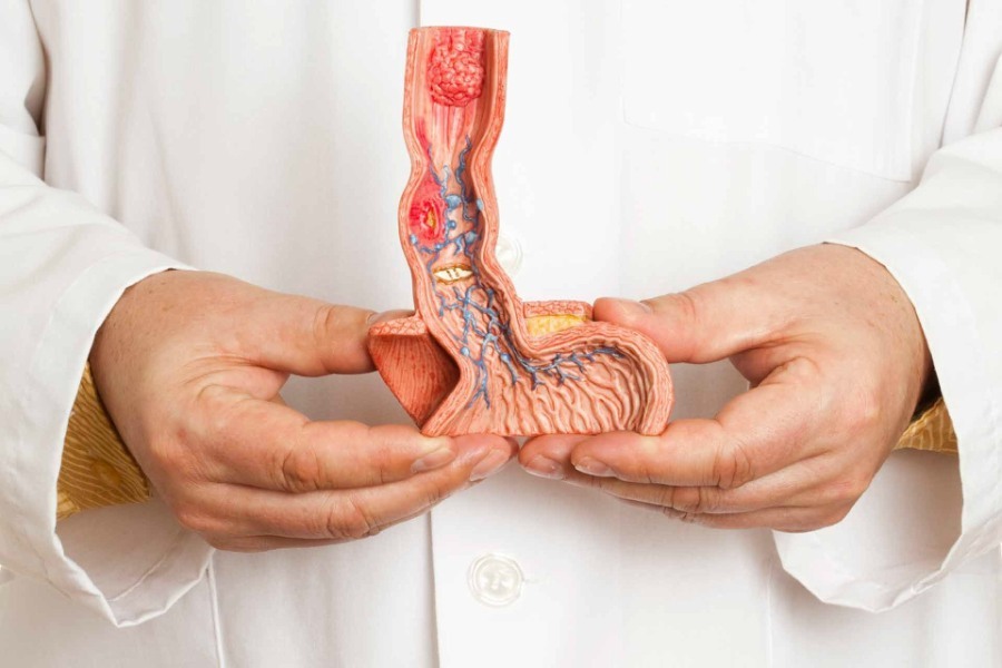 Ung thư dương vật: nguyên nhân, triệu chứng và cách điều trị 