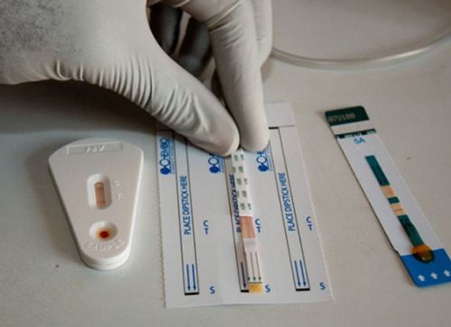 ✲Địa chỉ xét nghiệm HIV uy tín tin cậy tại Vĩnh Long