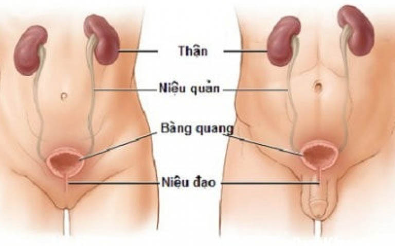 Viêm niệu đạo mãn tính – Suy thận nếu không chữa sớm