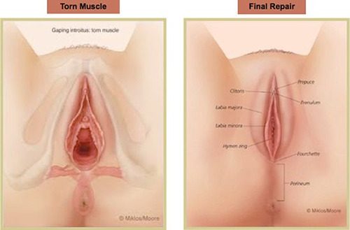 ✲Địa chỉ thu hẹp âm đạo uy tín tin cậy tại Bạc Liêu