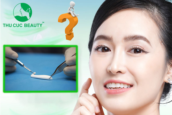 Nâng mũi silicon - Thu Cúc Sài Gòn