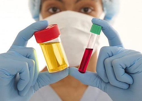 Nước tiểu có máu nguyên nhân là bệnh gì? Cách chữa trị