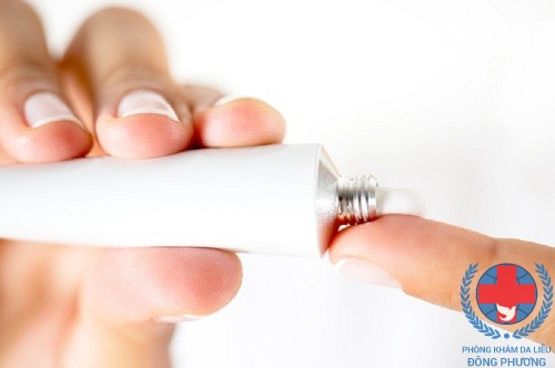 Bị zona thần kinh bôi thuốc gì và lưu ý khi dùng thuốc