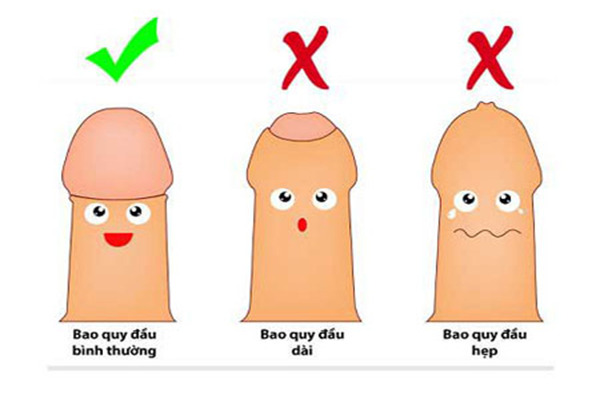 Địa chỉ cắt bao quy đầu ở Vĩnh Long uy tín