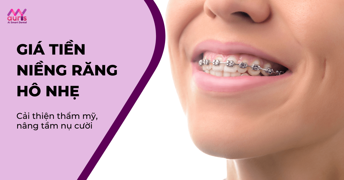 Giá tiền niềng răng hô nhẹ có đắt không?