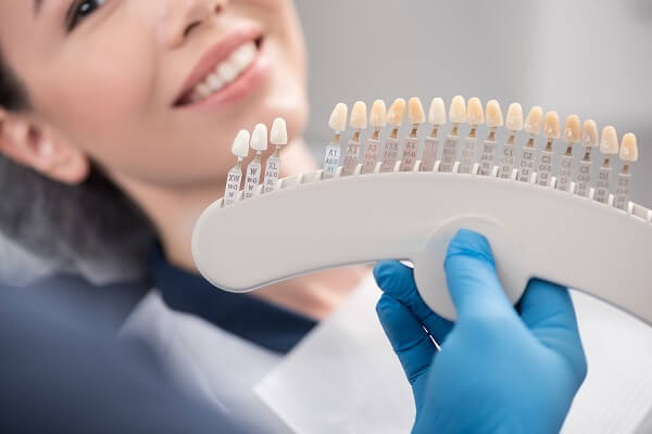 Improving Your Smile With Crowns Smith Lake AL