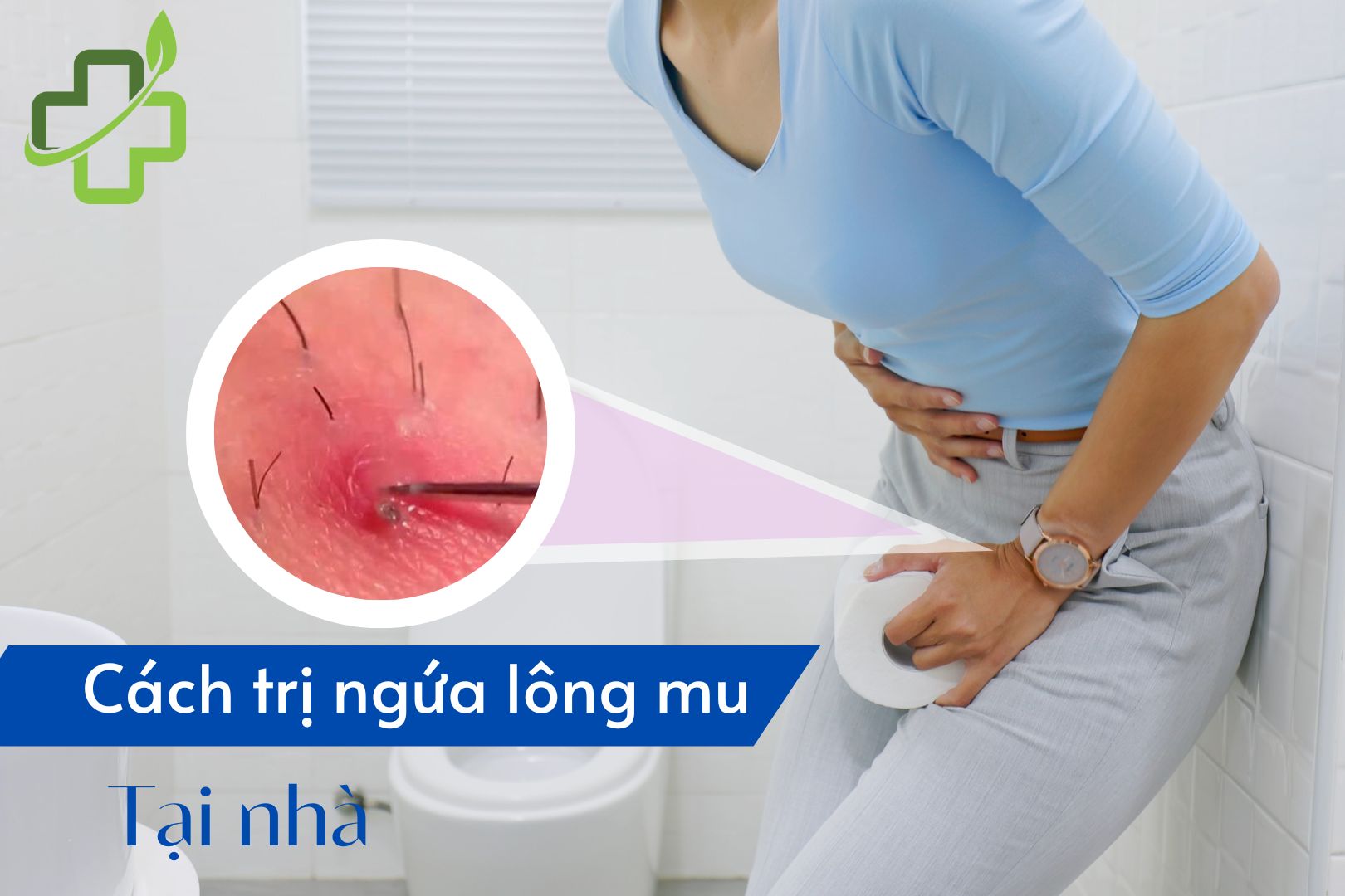 [Bỏ túi] 10+ Cách trị ngứa lông mu tại nhà chị em nên biết