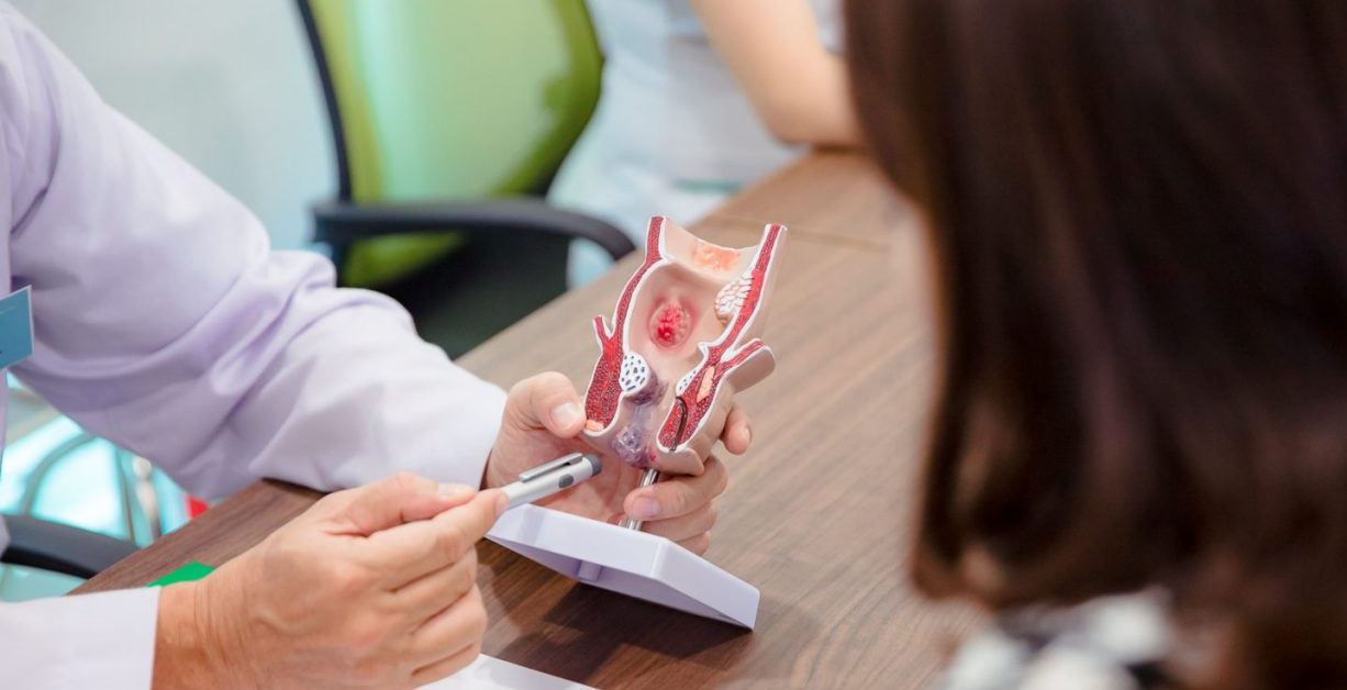 Bệnh trĩ khám ở khoa nào? Quy trình khám trĩ chuẩn - Chào Bác Sĩ
