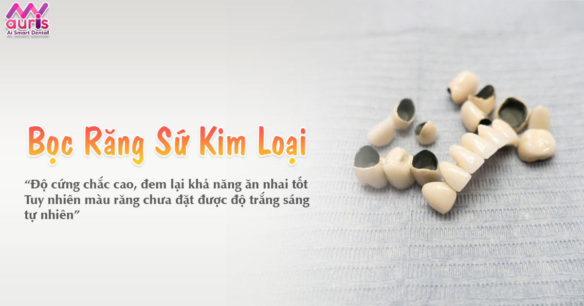 Giải đáp bọc răng sứ kim loại thường có tốt không?