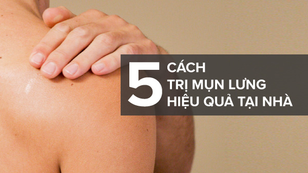 Cách trị mụn lưng hiệu quả tại nhà ai cũng có thể thực hiện