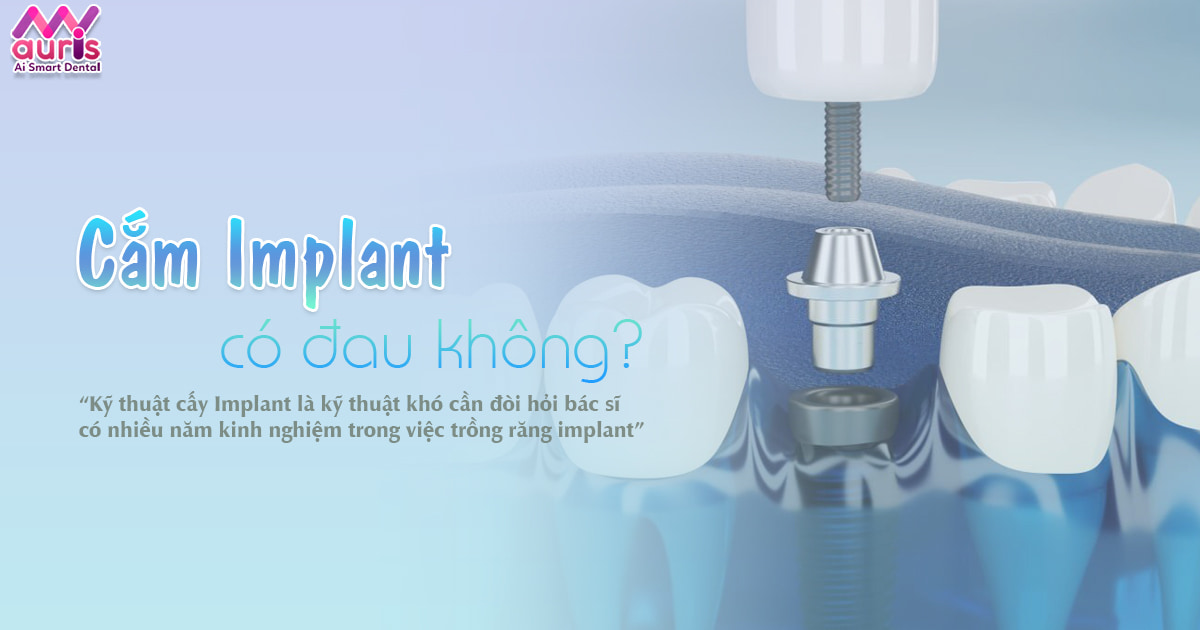 Cắm Implant có đau không? Quy trình thực hiện - Nha Khoa My Auris