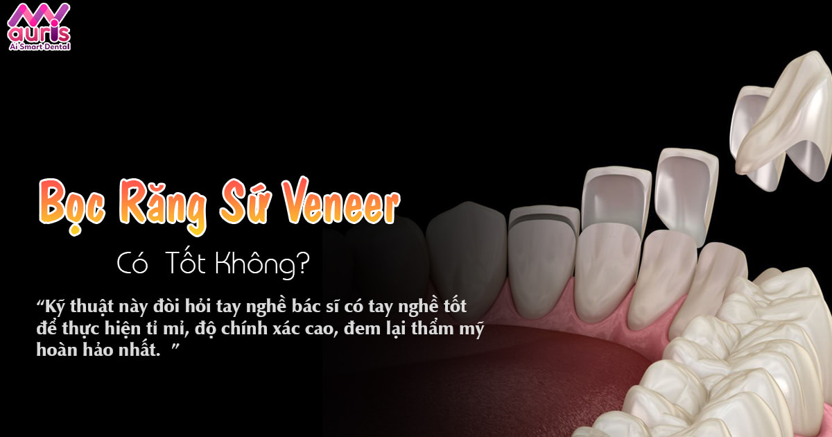 Hỏi đáp bọc răng sứ veneer có tốt không?
