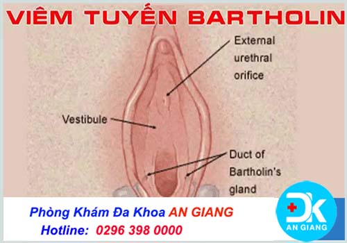 Môi lớn bị sưng đau rát là bị bệnh gì? Cách chữa trị