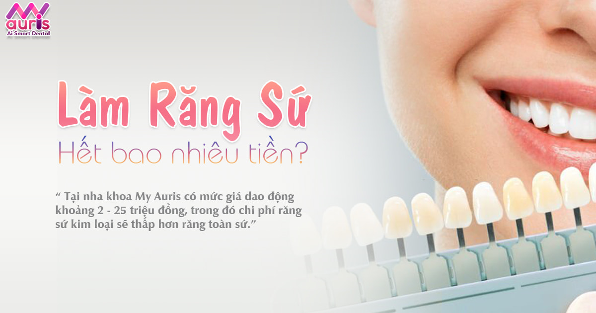 Làm răng sứ hết bao nhiêu tiền cho 2 dòng sứ phổ biến nhất - Nha Khoa My Auris