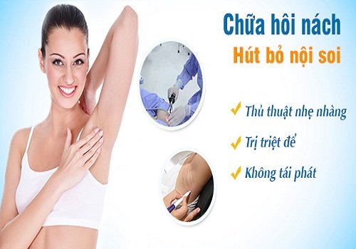 Trị hôi nách bằng công nghệ xâm lấn tối thiểu có hiệu quả không?