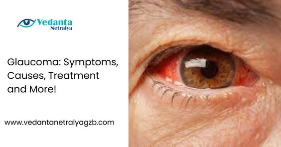 Glaucoma: Symptoms, Causes, Treatment and More! — Vedanta Netralya