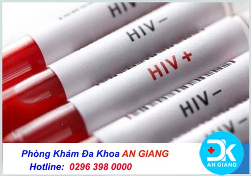 Nên xét nghiệm hiv ở đâu? Địa chỉ nào ở An Giang?