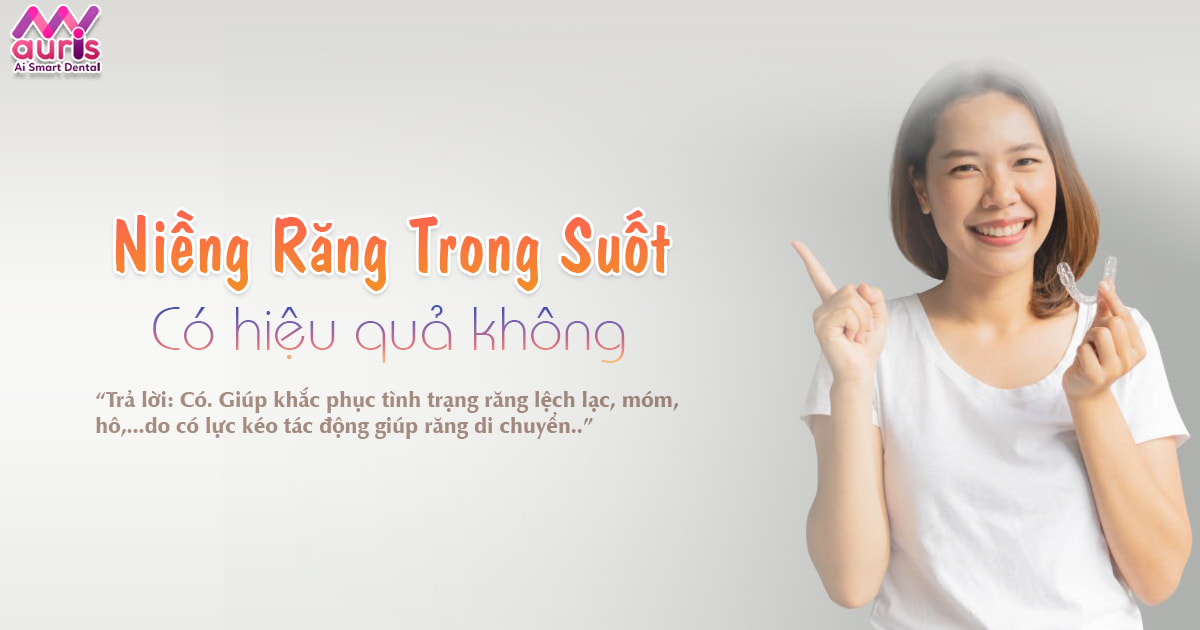 Phương pháp niềng răng trong suốt có hiệu quả như bạn nghĩ? - Nha Khoa My Auris