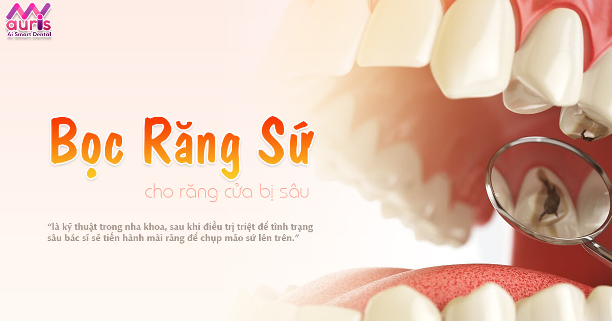 Vì sao bọc răng sứ cho răng cửa bị sâu ?