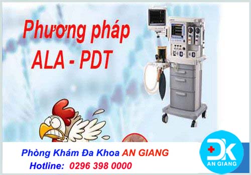 Ala pdt là gì? Điều trị sùi mào gà bằng phương pháp ala-pdt có hiệu quả