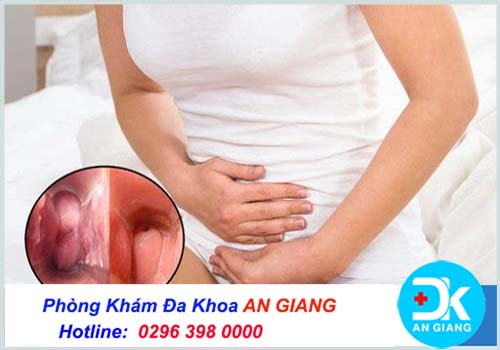 Nổi mụn ở âm đạo phụ nữ cảnh báo bệnh nguy hiểm gì?