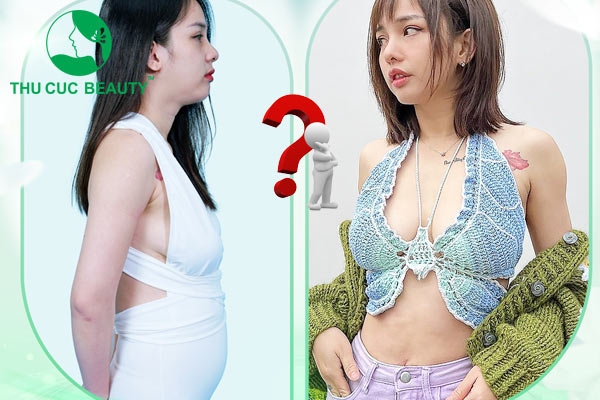 Hút mỡ bụng - Thu Cúc Sài Gòn