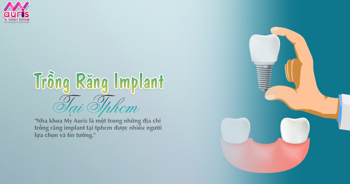 Tìm hiểu về trồng răng implant tại tphcm