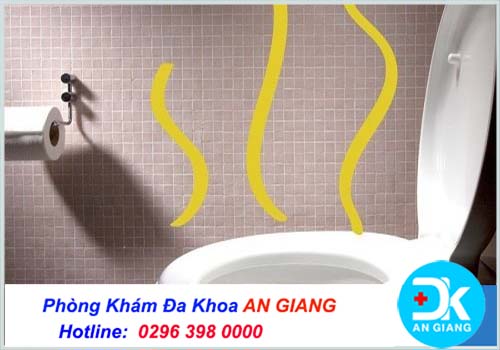 Nước tiểu vàng ****c và có mùi hôi, mùi khai nặng là bị gì?