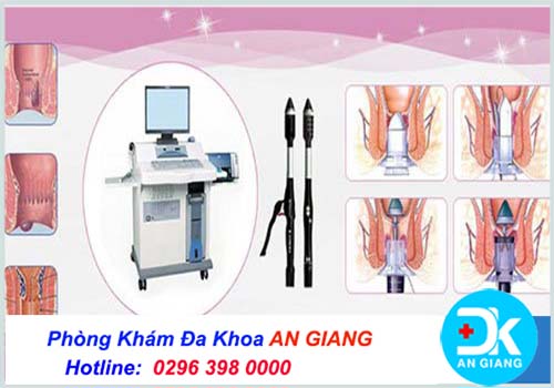 Mẹo - Cách chữa trị bệnh lòi dom tại nhà hiệu quả