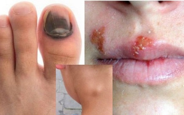 Phòng khám chữa bệnh lậu tại Hà Đông uy tín - hiệu quả