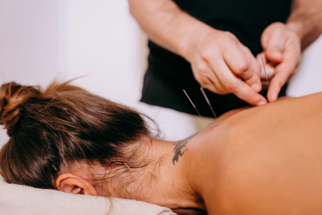 How dry needling is an effective treatment to reduce chronic pain and stress?