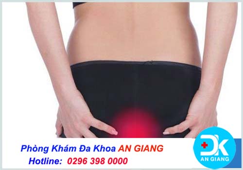 Bệnh trĩ ngoại: Nguyên nhân, dấu hiệu và cách chữa trị an toàn