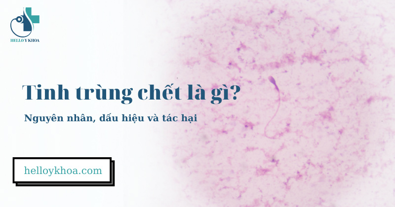 Tinh trùng chết là gì? Nguyên nhân, dấu hiệu và tác hại tinh trùng chết nhiều