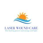 Laser Wound Care