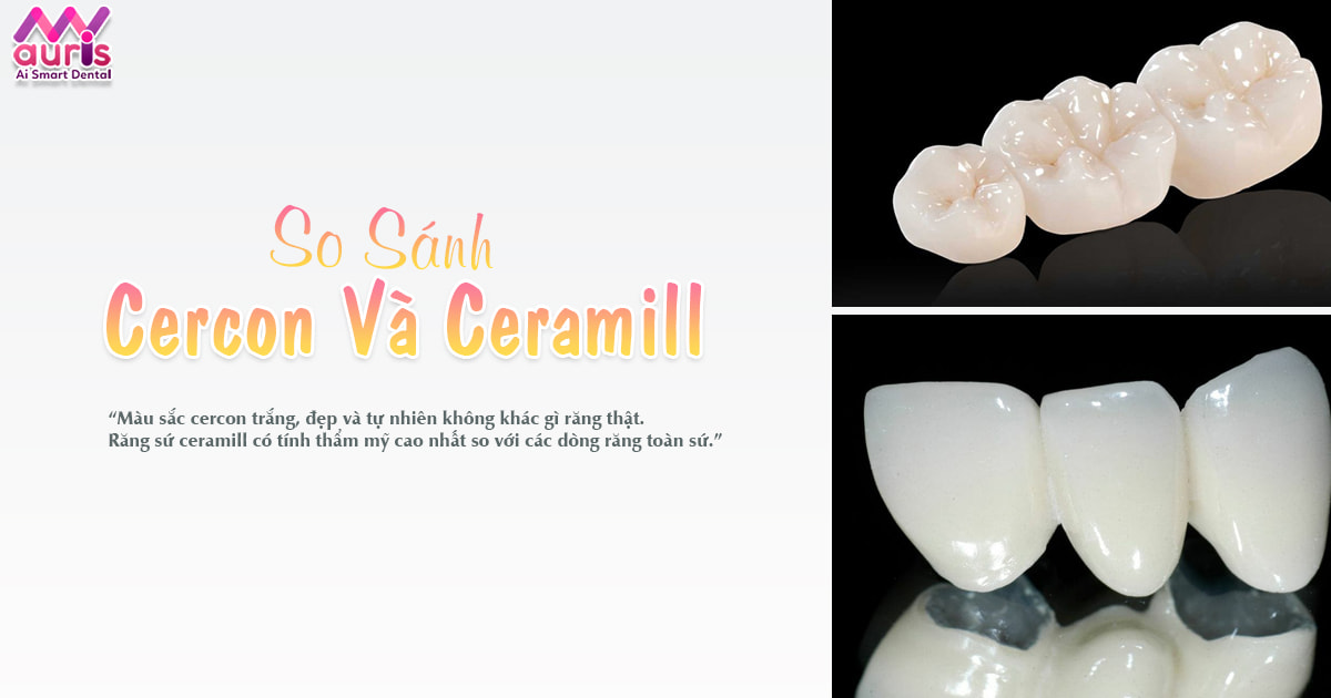 So sánh răng sứ cercon và ceramill - 6 tiêu chí đánh giá