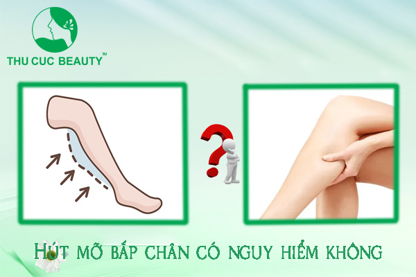 Hút mỡ bắp chân có nguy hiểm không? - Thu Cúc Sài Gòn
