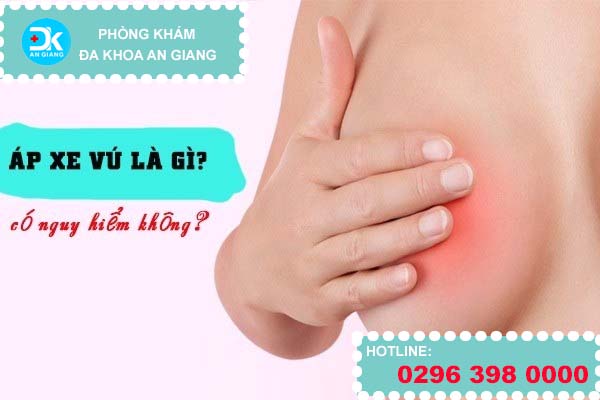Áp xe vú là gì? có nguy hiểm không?