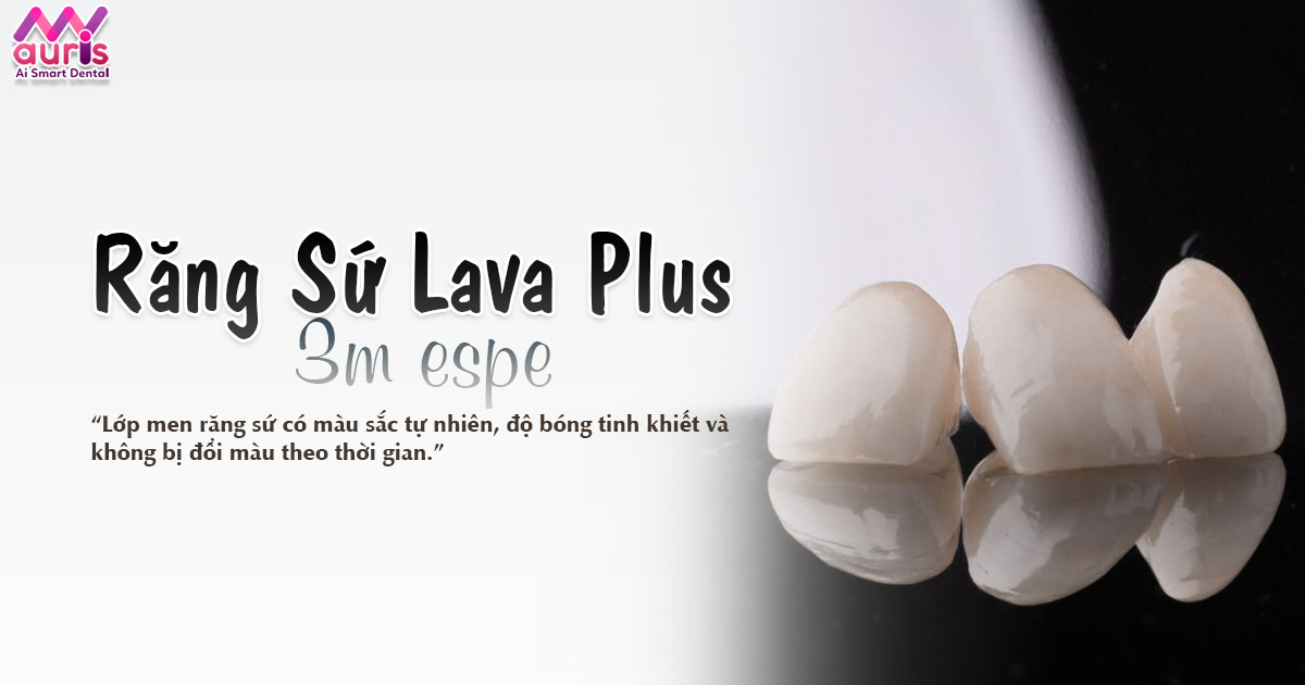 Răng sứ Lava plus 3m espe thuộc dòng răng sứ nào? - Nha Khoa My Auris
