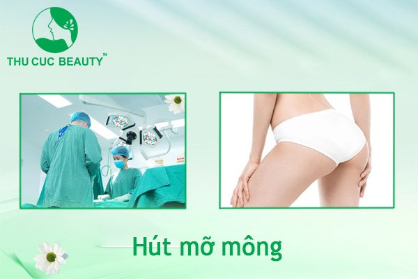 Hút mỡ mông - Giải pháp cho vòng 3 căng tròn quyến rũ