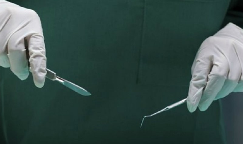 Giải đáp thắc mắc có nên cắt bao quy đầu không ?