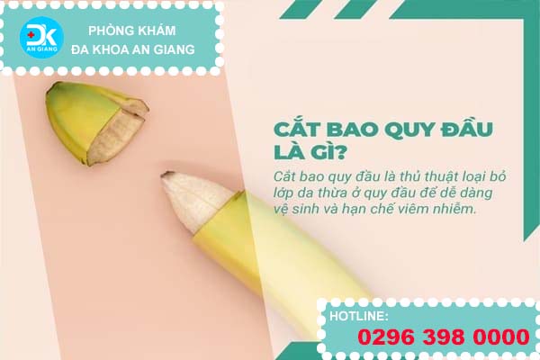 Cắt bao quy đầu ở An Giang tốn bao nhiêu tiền?